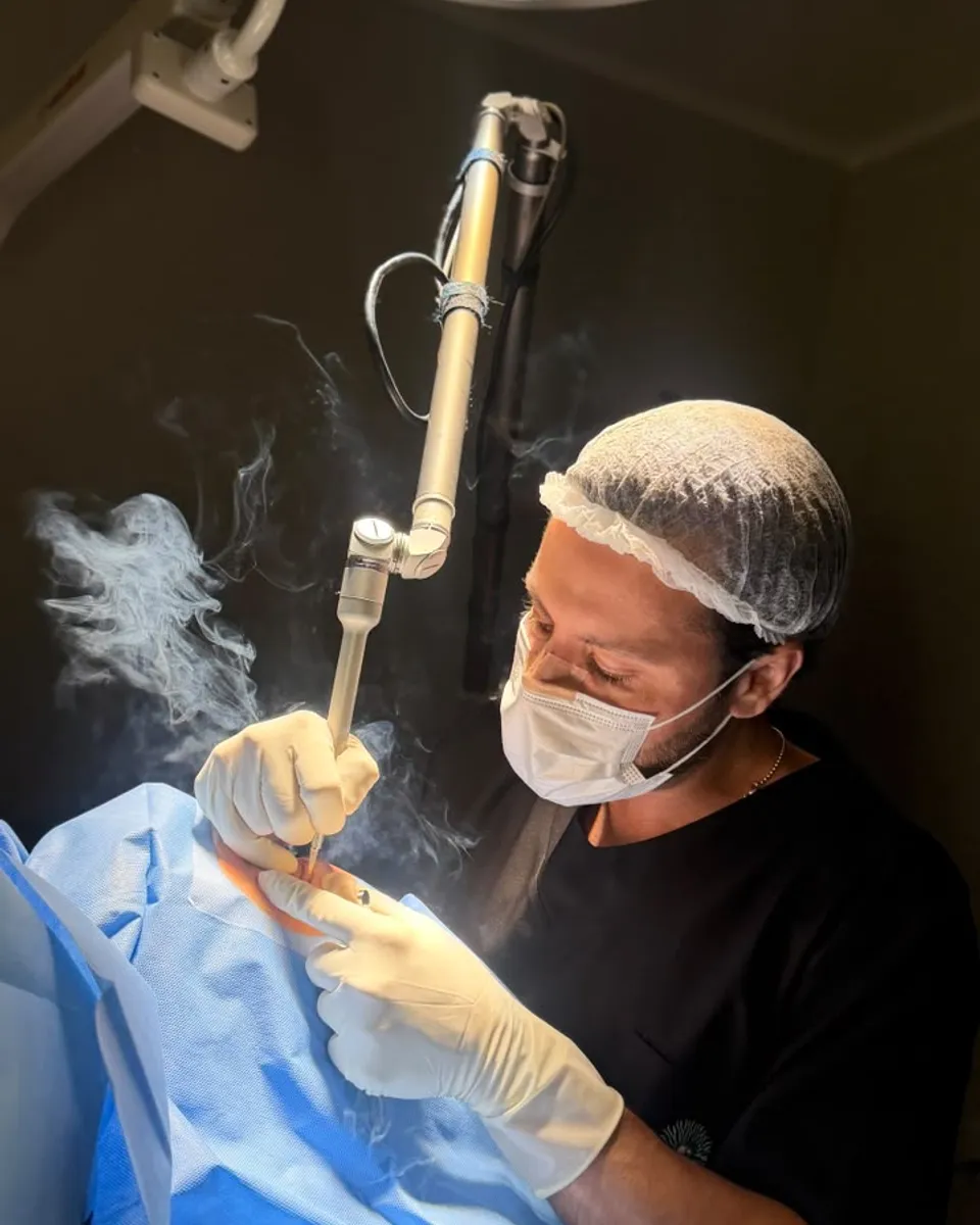 Dr. Guilherme Valério operando uma pálpebra com laser de CO2 no centro cirúrgico